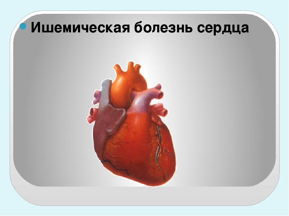 Ишемическая болезнь сердца